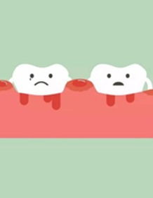 合众齿科来答疑：牙龈出血是什么原因造成的